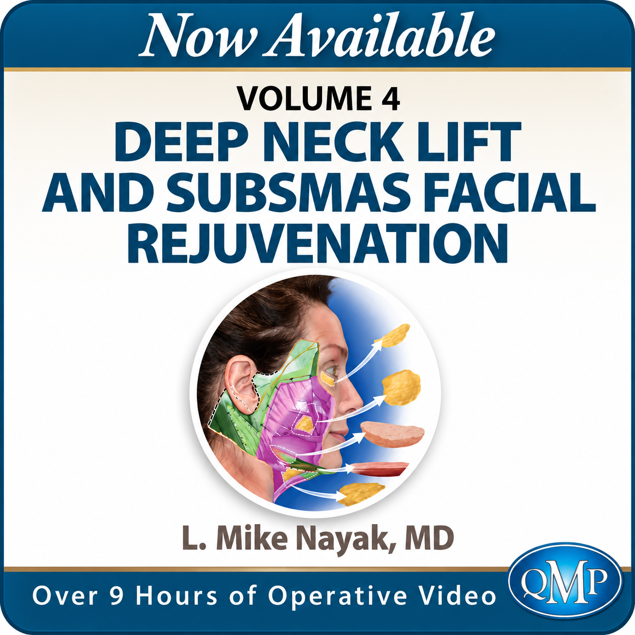 MP Deep Neck Lift and SubSMAS Facial Rejuvenation Volume 4 – Mike Nayak 2026