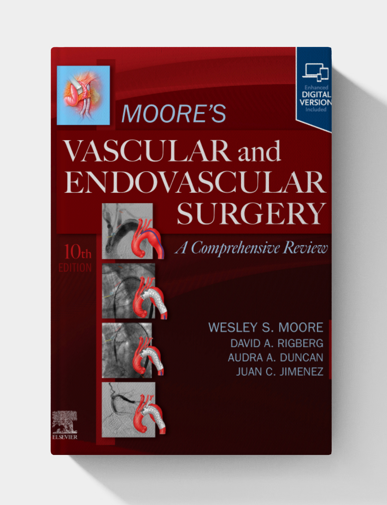 Moore’s Vascular and Endovascular Surgery: A Comprehensive Review, 10th edition